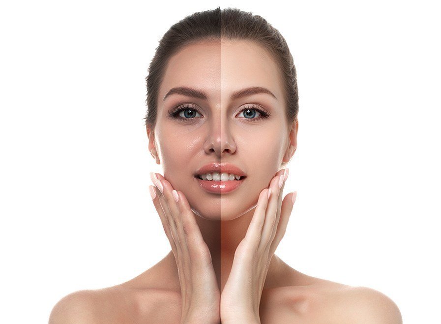 8 Things About Skin Whitening Treatment You May Not Have Known Best Cosmeti...